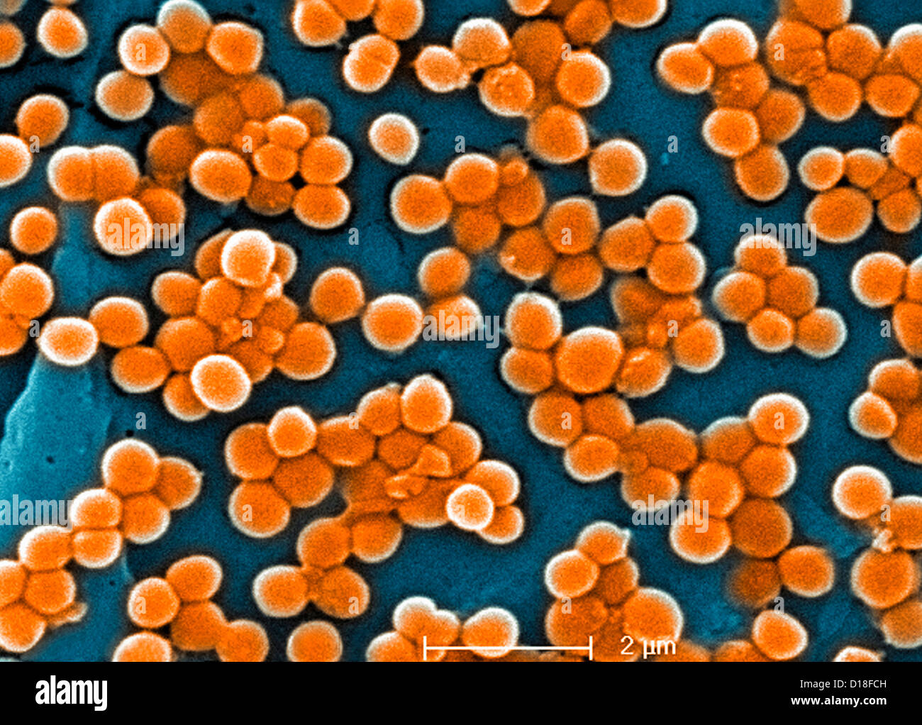 Micrographie électronique à balayage du SARM Banque D'Images