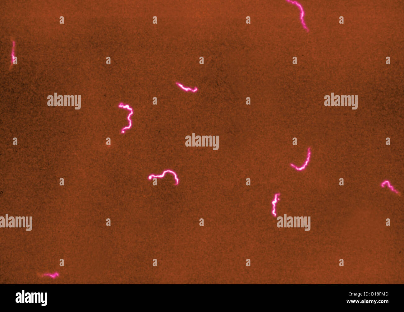 Syphilis Bacteria Banque d'image et photos - Alamy