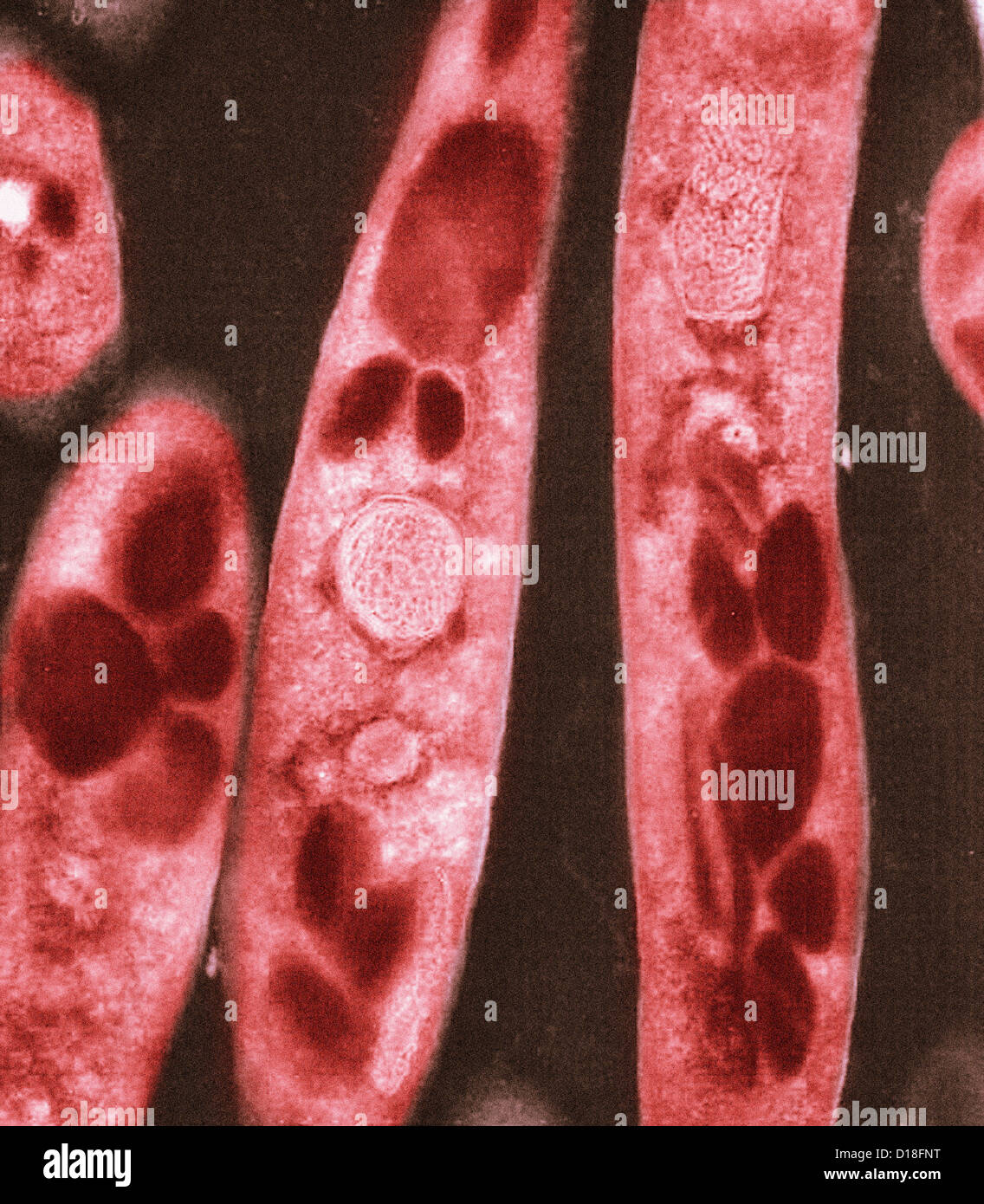 Micrographe de bactéries Bacillus anthracis Banque D'Images