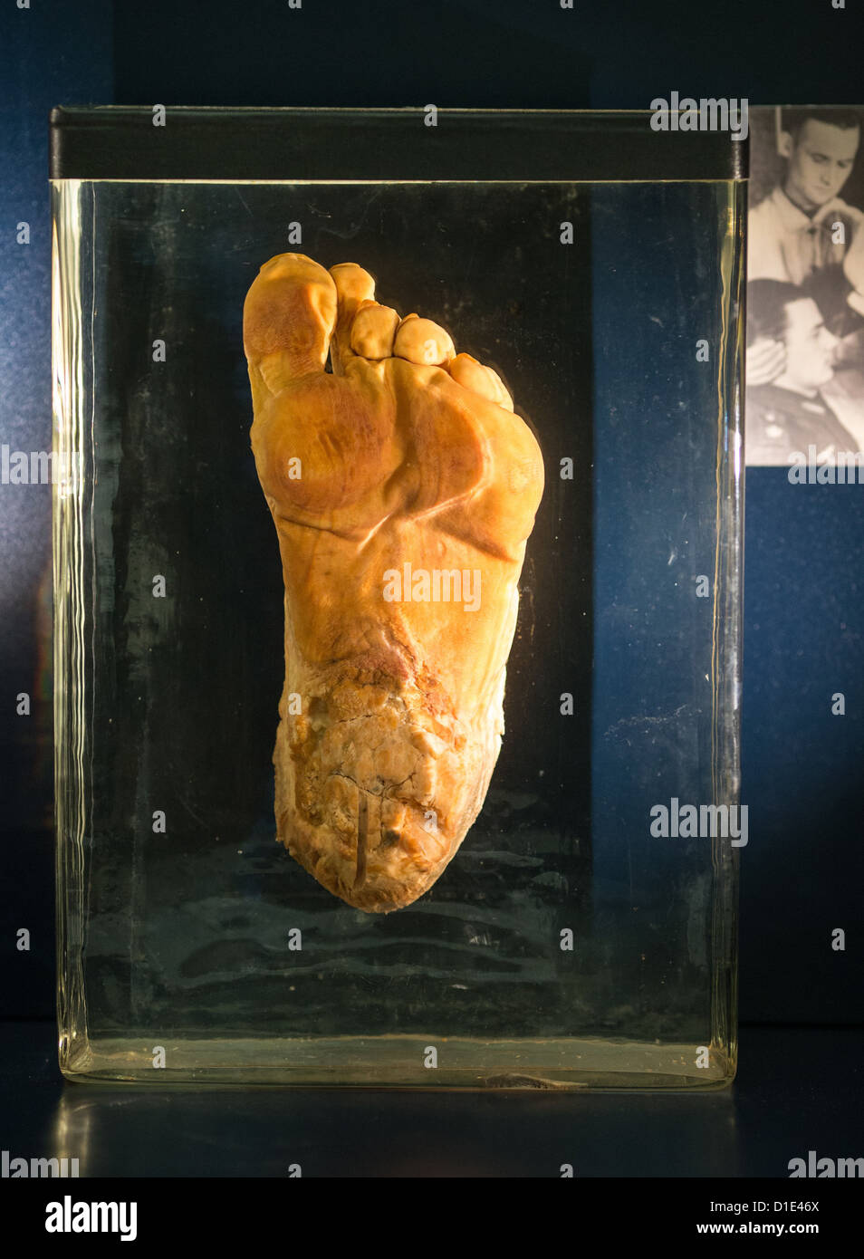 Le pied amputé d'un soldat de la Wehrmacht est exposée à la nouvelle exposition spéciale 'Stalingrad' au Musée de l'histoire militaire de la Bundeswehr à Dresde, Allemagne, le 14 décembre 2012. L'exposition sera ouverte le 15 décembre 2012 et de jeter un oeil à la bataille de Stalingrad à partir d'un point de vue allemand et russe. Photo : OLIVER KILLIG Banque D'Images