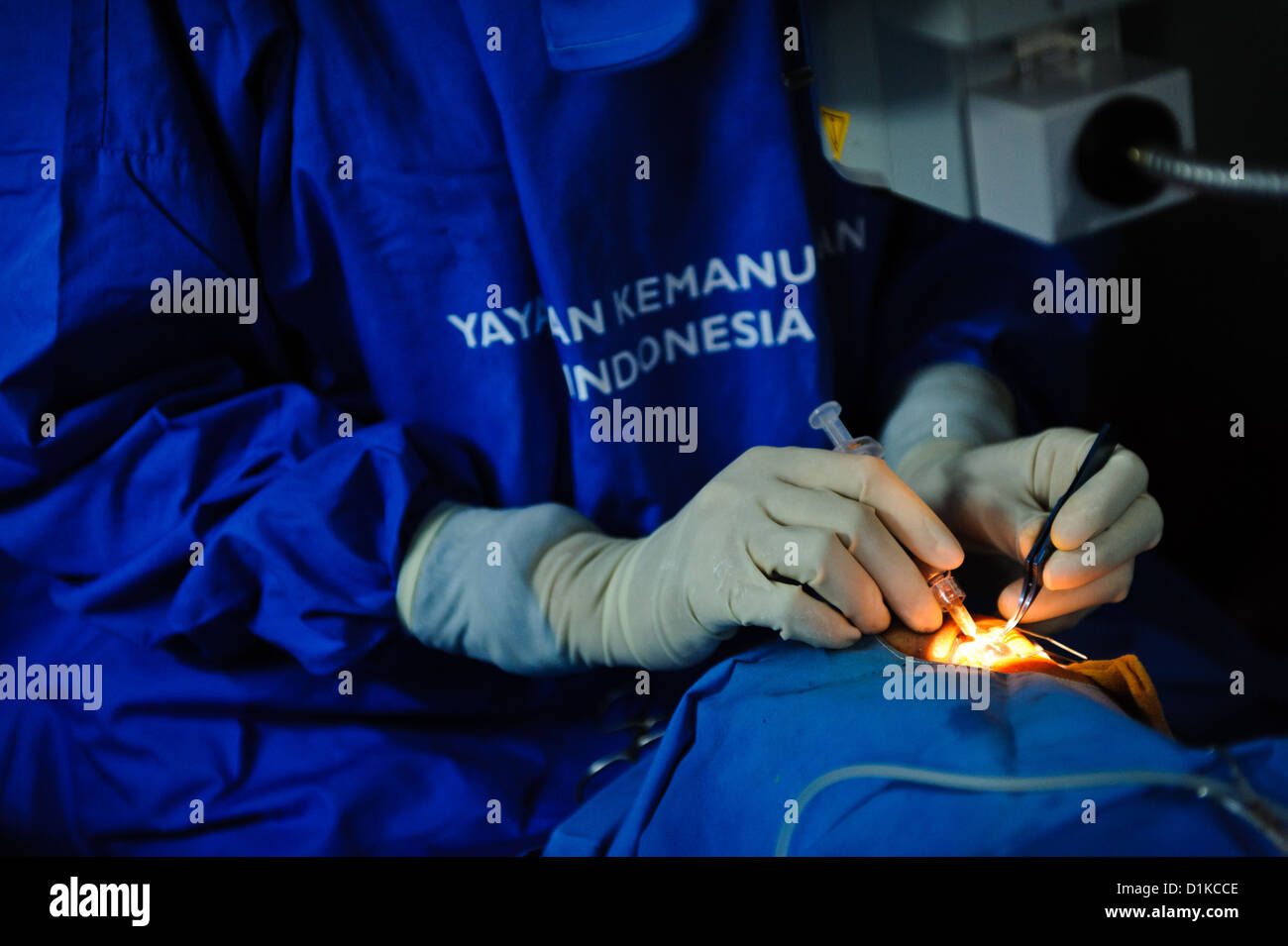 Un patient subissant une chirurgie de la cataracte dans une clinique mobile, Bali, Indonésie. Banque D'Images