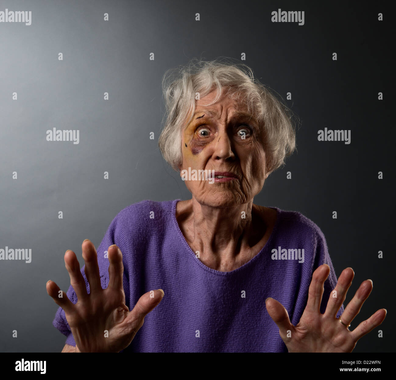 Abus senior woman with black eye. Banque D'Images