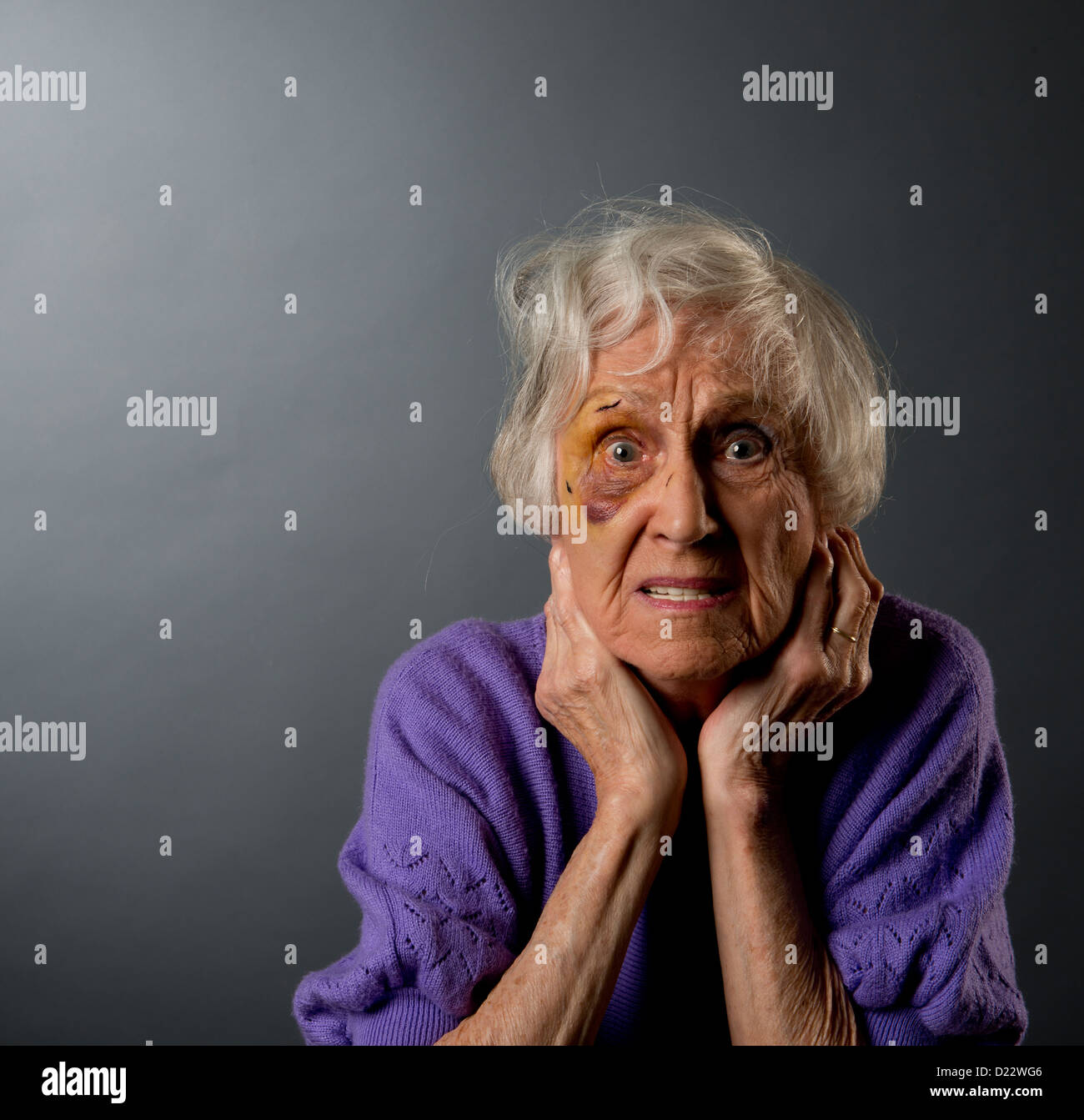 Abus senior woman with black eye. Banque D'Images