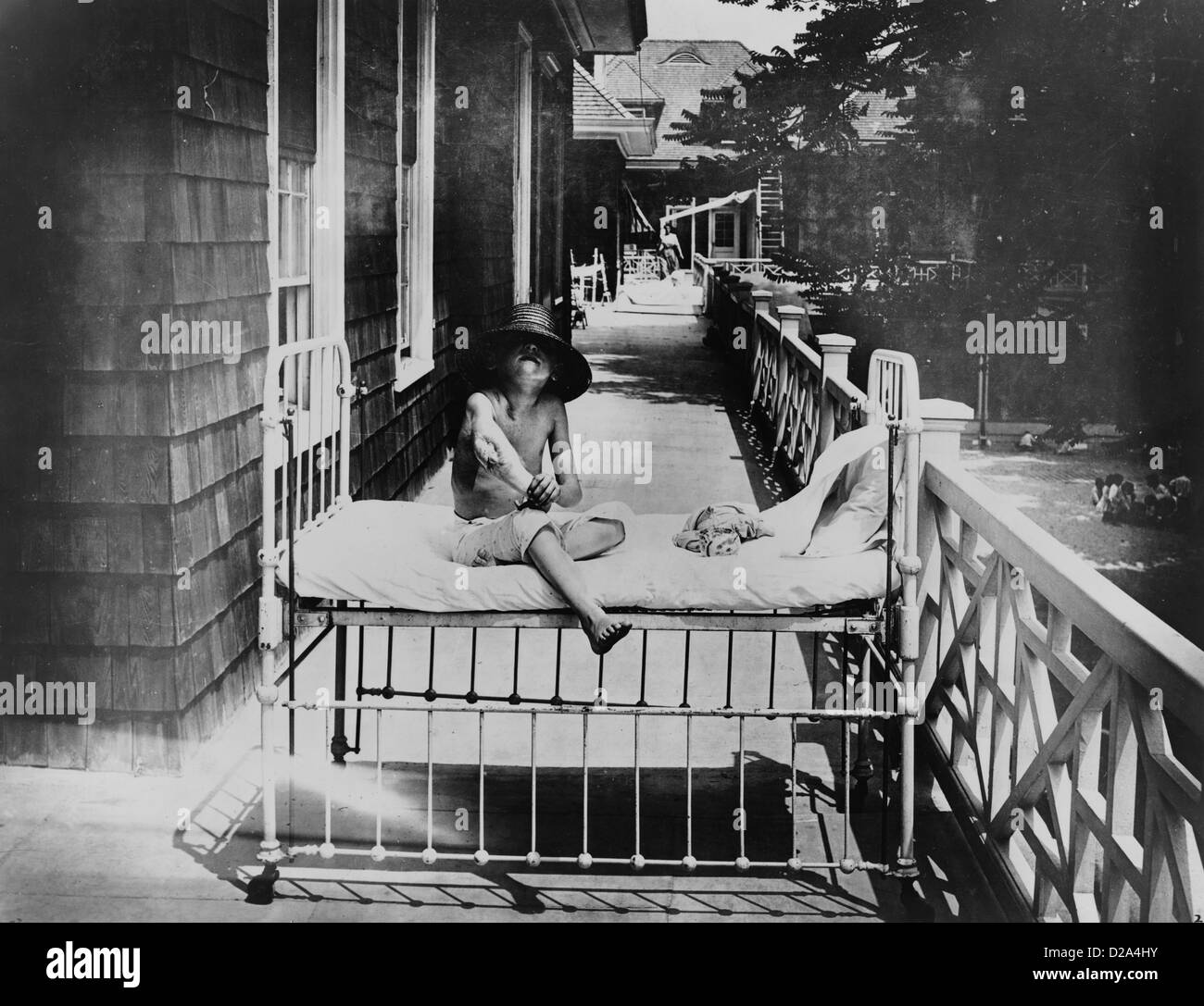 Enfants tuberculeux assis sur lit, à l'extérieur, à l'hôpital de brise de mer, Coney Island, New York. Entre 1900 et 1920 Banque D'Images