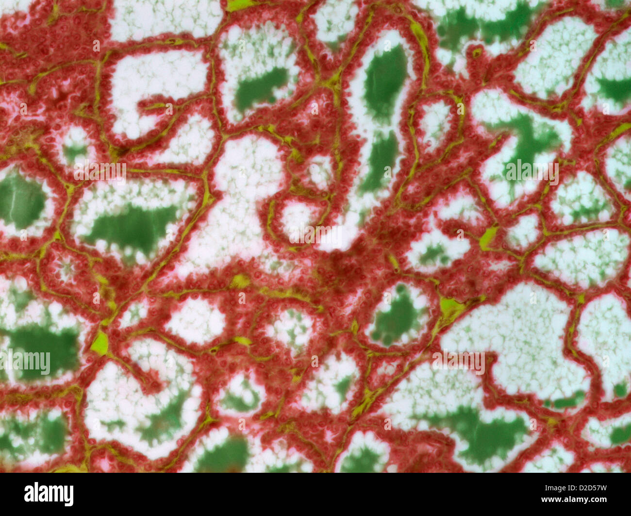 Les tissus mammaires allaitantes micrograph Light d'une section à travers le tissu de sein en lactation humaine Banque D'Images
