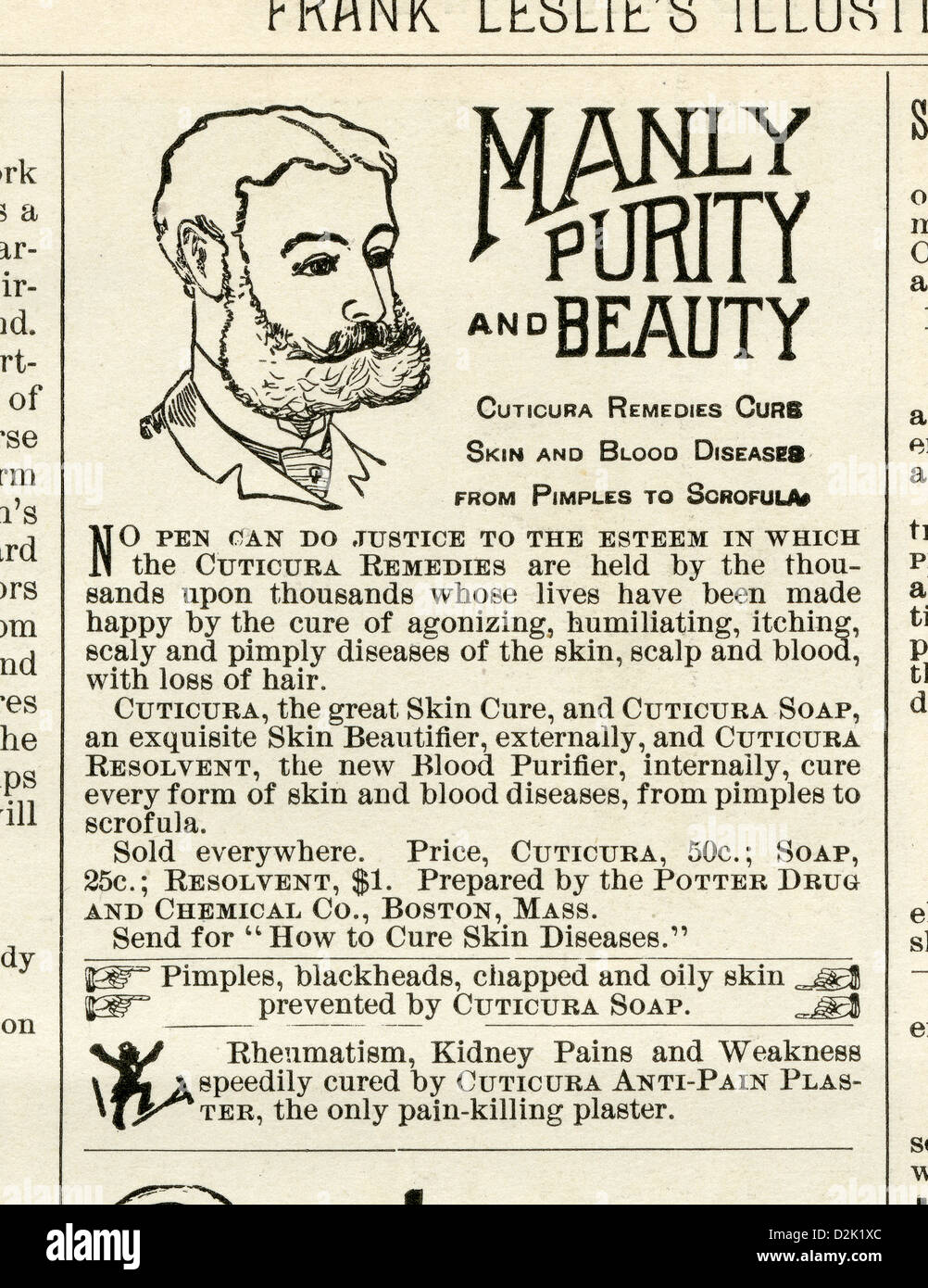 1890, publicité Cuticura Cure peau remèdes et les maladies du sang à partir de boutons à la scrofule. Banque D'Images