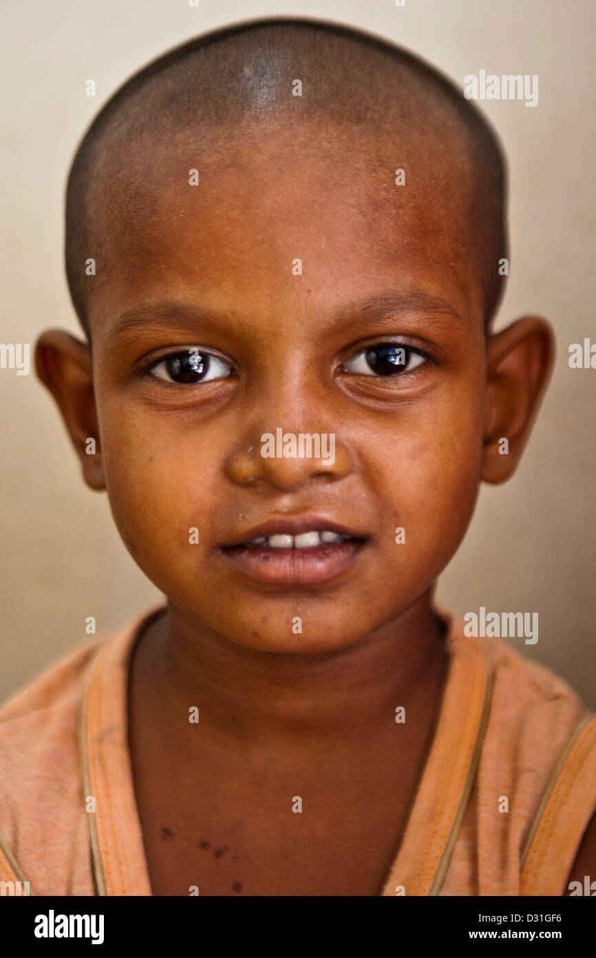 Un jeune enfant indien qui est un patient dans un dispensaire dans Tehkhand Slum, Delhi, Inde. Banque D'Images