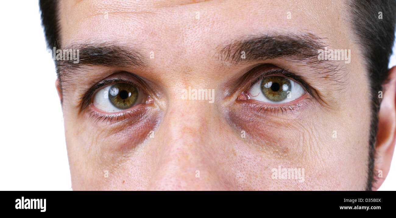 Yeux très fatigué d'un homme blanc Photo Stock - Alamy