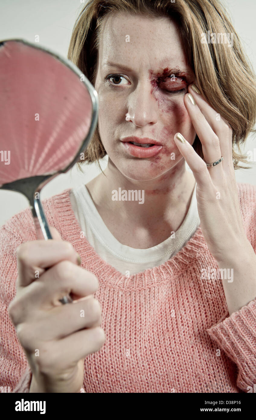 L'examen de son visage meurtri Femme Banque D'Images