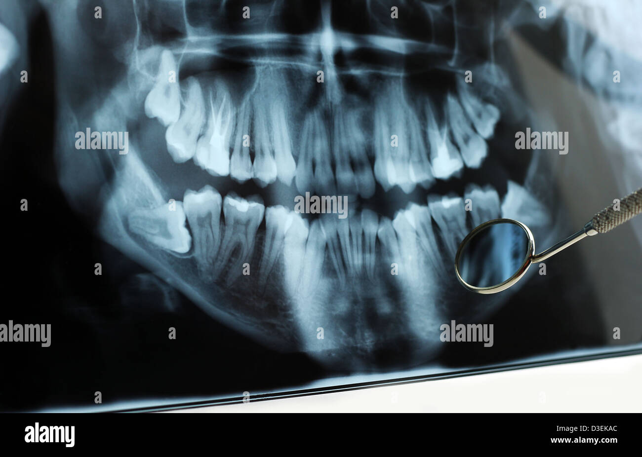 Dental x-ray reflétée dans un miroir dentaire. Banque D'Images