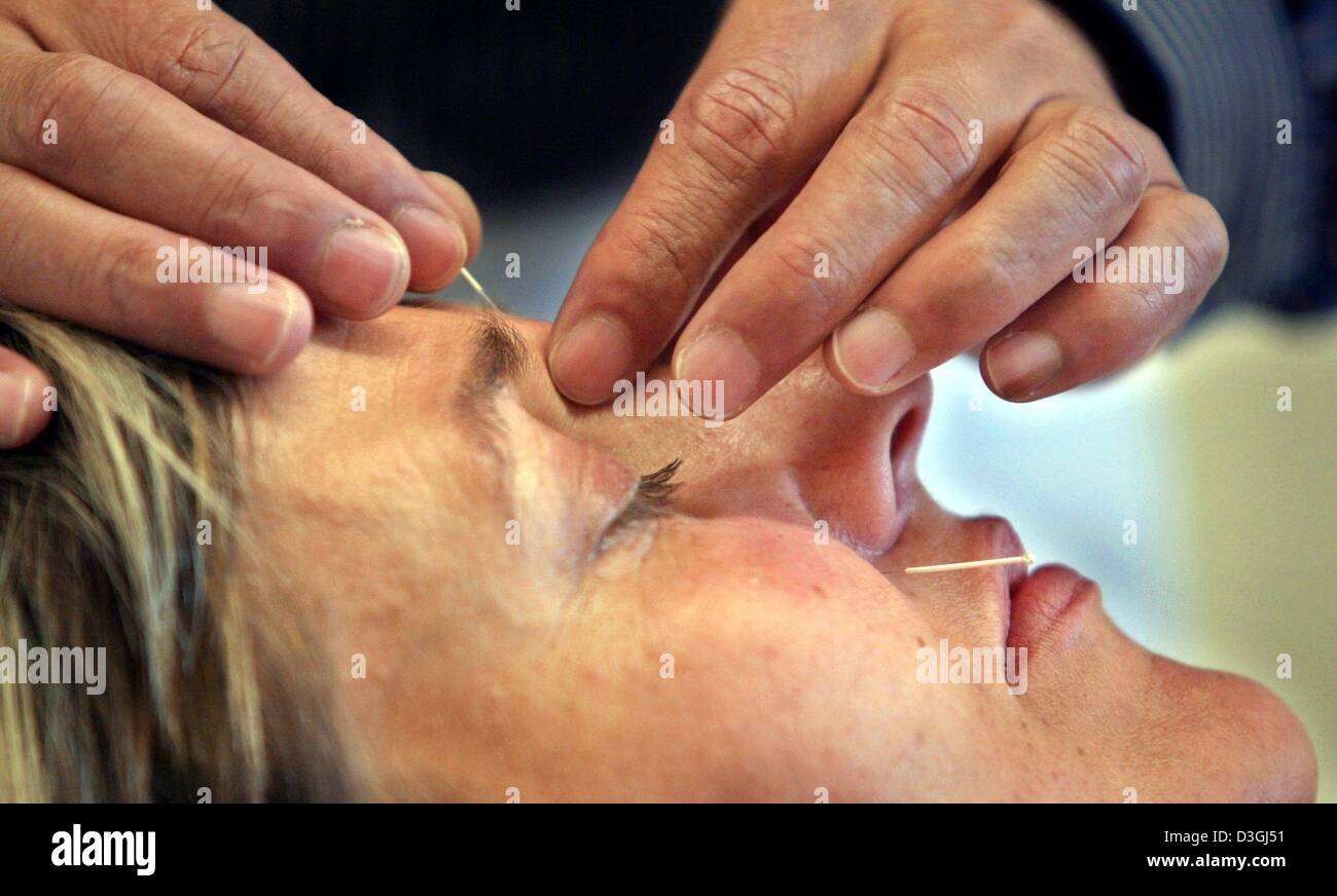 Afp) - Un patient est traité avec une aiguille d'acupuncture sur la racine  de son nez à la clinique de la médecine traditionnelle chinoise à  Ottobeuren, Allemagne, 23 juin 2004 Photo Stock - Alamy