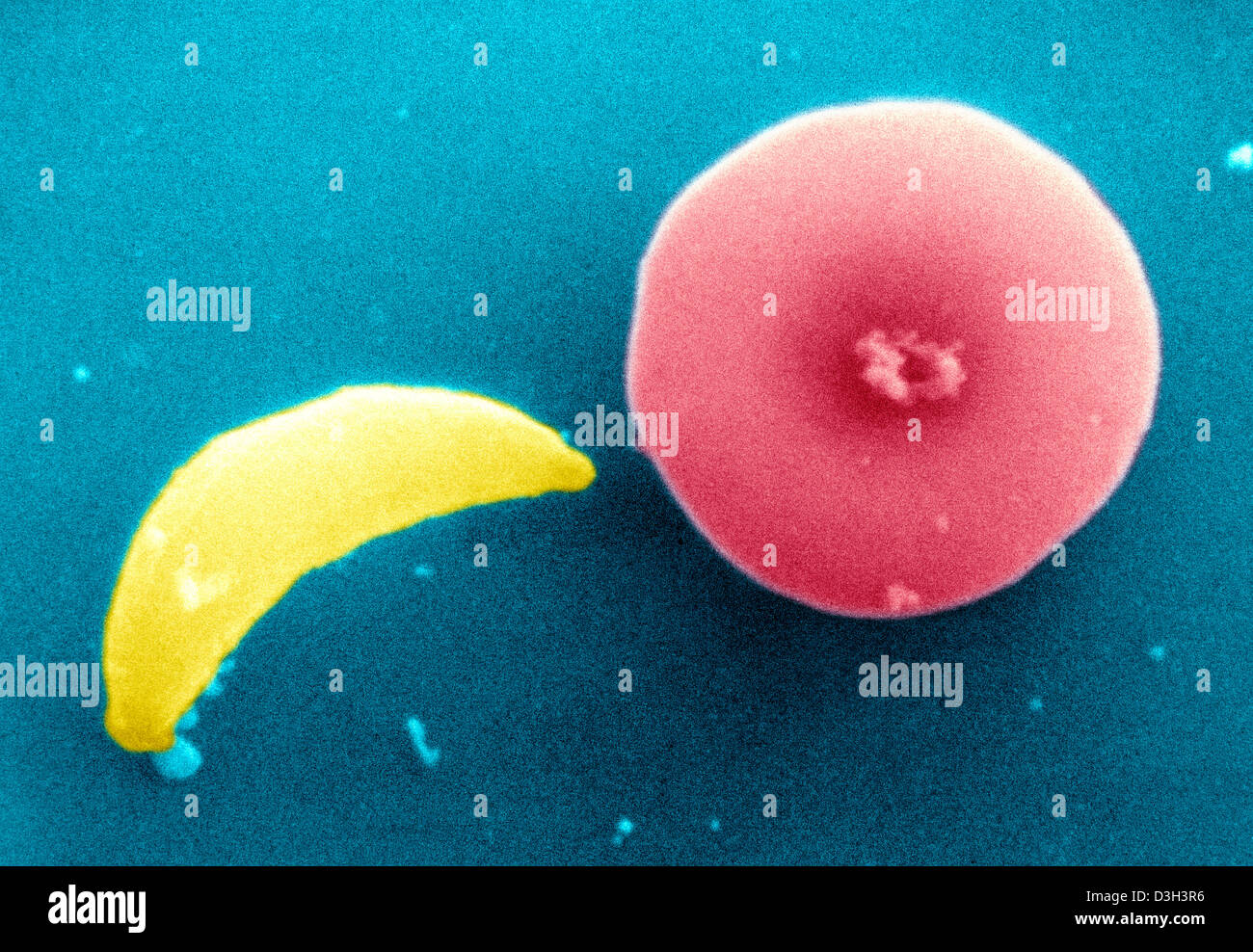 TOXOPLASMA GONDII Banque D'Images