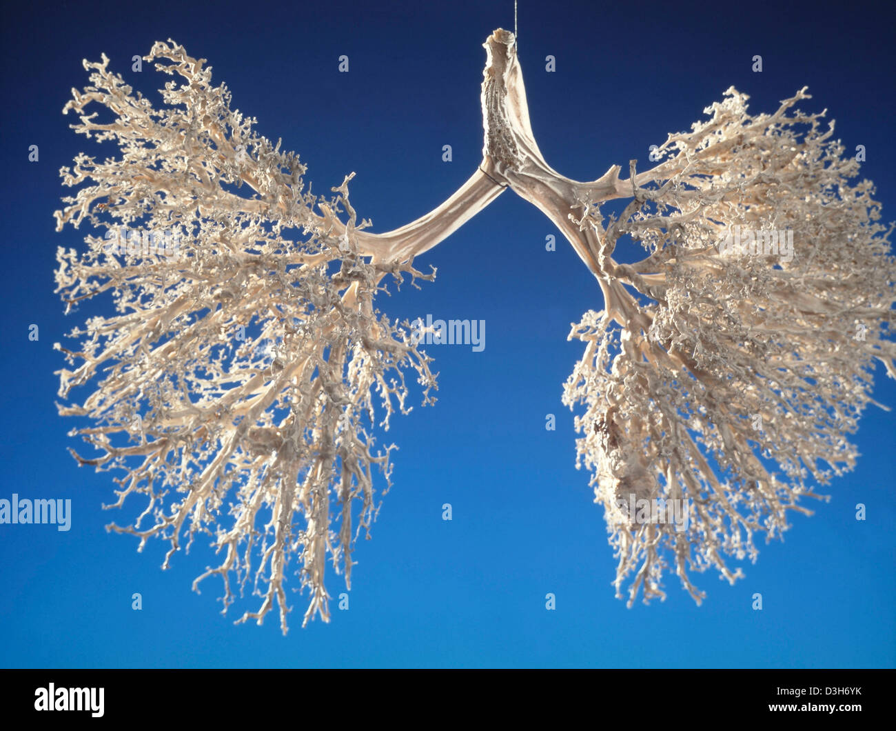 Des bronches, de l'anatomie Photo Stock - Alamy