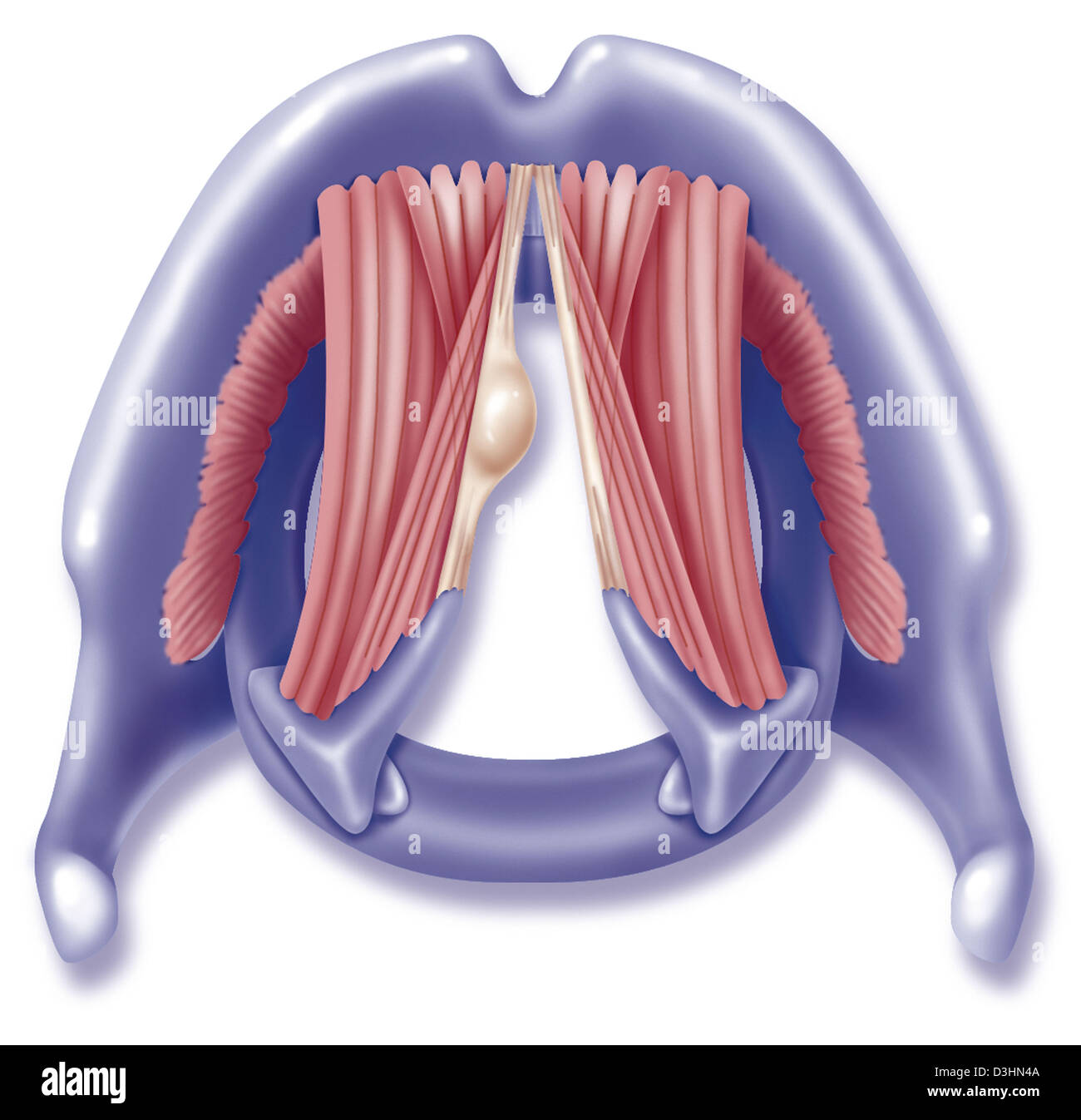 Polype corde vocale Banque D'Images