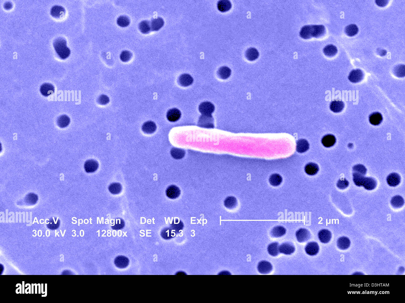 L'ESCHERICHIA COLI, SEM Banque D'Images