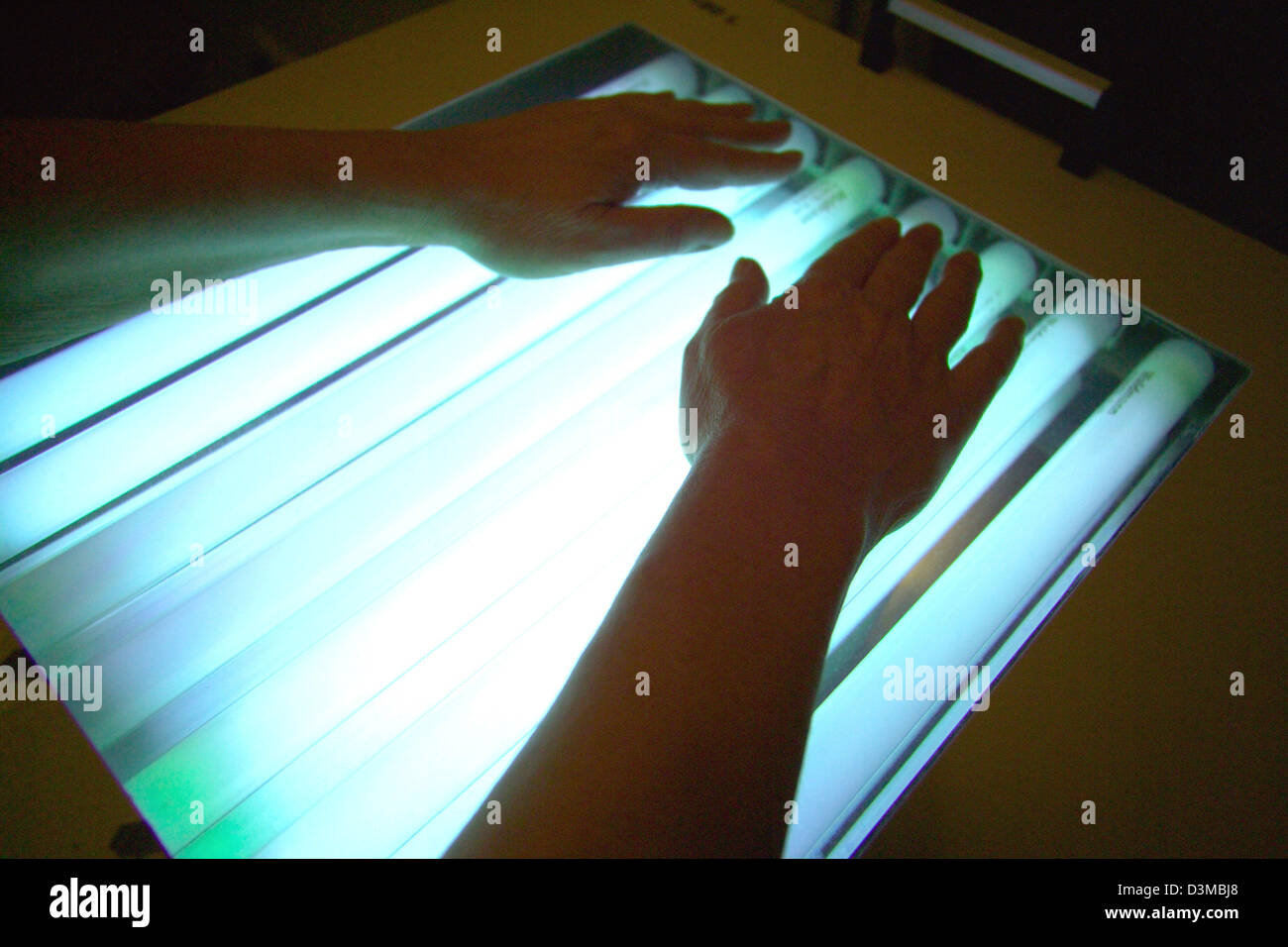 (Afp) - Un patient atteint de psoriasis met ses mains et ses bras sur une lampe à ultraviolet comprimé dans le centre de Bad Salzuflen, Allemagne, 10 février 2005. Le traitement par la lumière ultraviolette peut soulager les symptômes du psoriasis de type A et B. Photo : Klaus Rose Banque D'Images (Afp) - Un patient atteint de psoriasis met ses mains et ses bras sur une lampe à ultraviolet comprimé dans le centre de Bad Salzuflen, Allemagne, 10 février 2005. Le traitement par la lumière ultraviolette peut soulager les symptômes du psoriasis de type A et B. Photo : Klaus Rose Banque D'Images