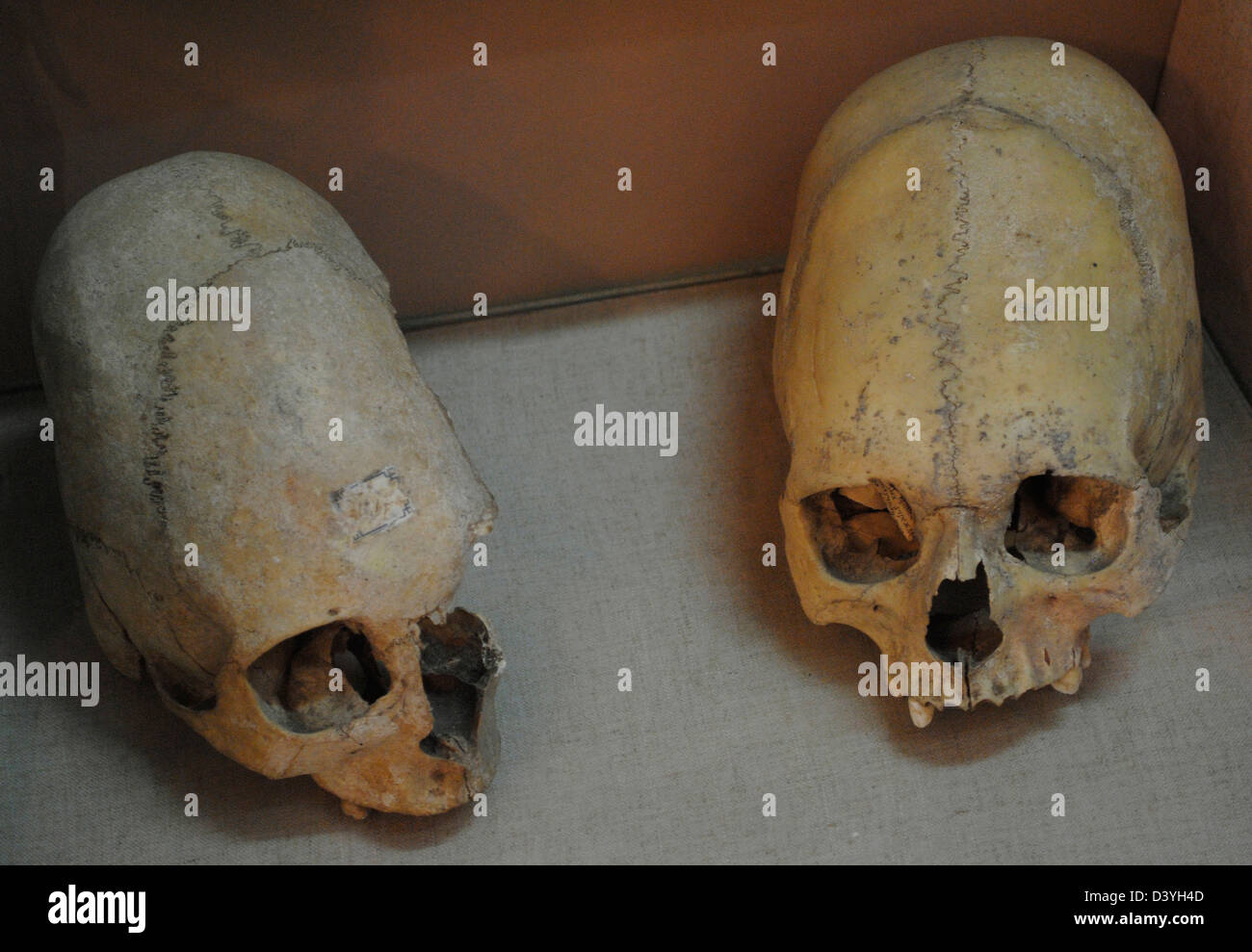 Sarmates. Deux crânes humains déformés. En date probablement au 3ème siècle avant JC. Musée historique et archéologique de Kertch. Banque D'Images