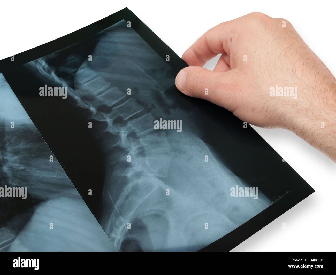La radiographie de la colonne vertébrale Banque D'Images