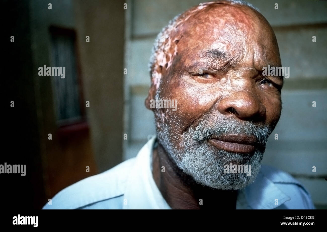 Heidelberg, Afrique du Sud, cet homme a été battu jusqu'à l'aide d'une chaîne Banque D'Images