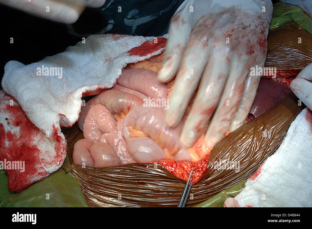 Les boucles de l'intestin normal holding chirurgien Banque D'Images