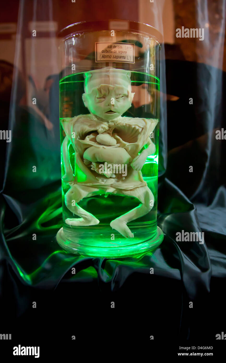 Conservé dans un bocal fœtus bébé avec des organes montrant Photo Stock -  Alamy