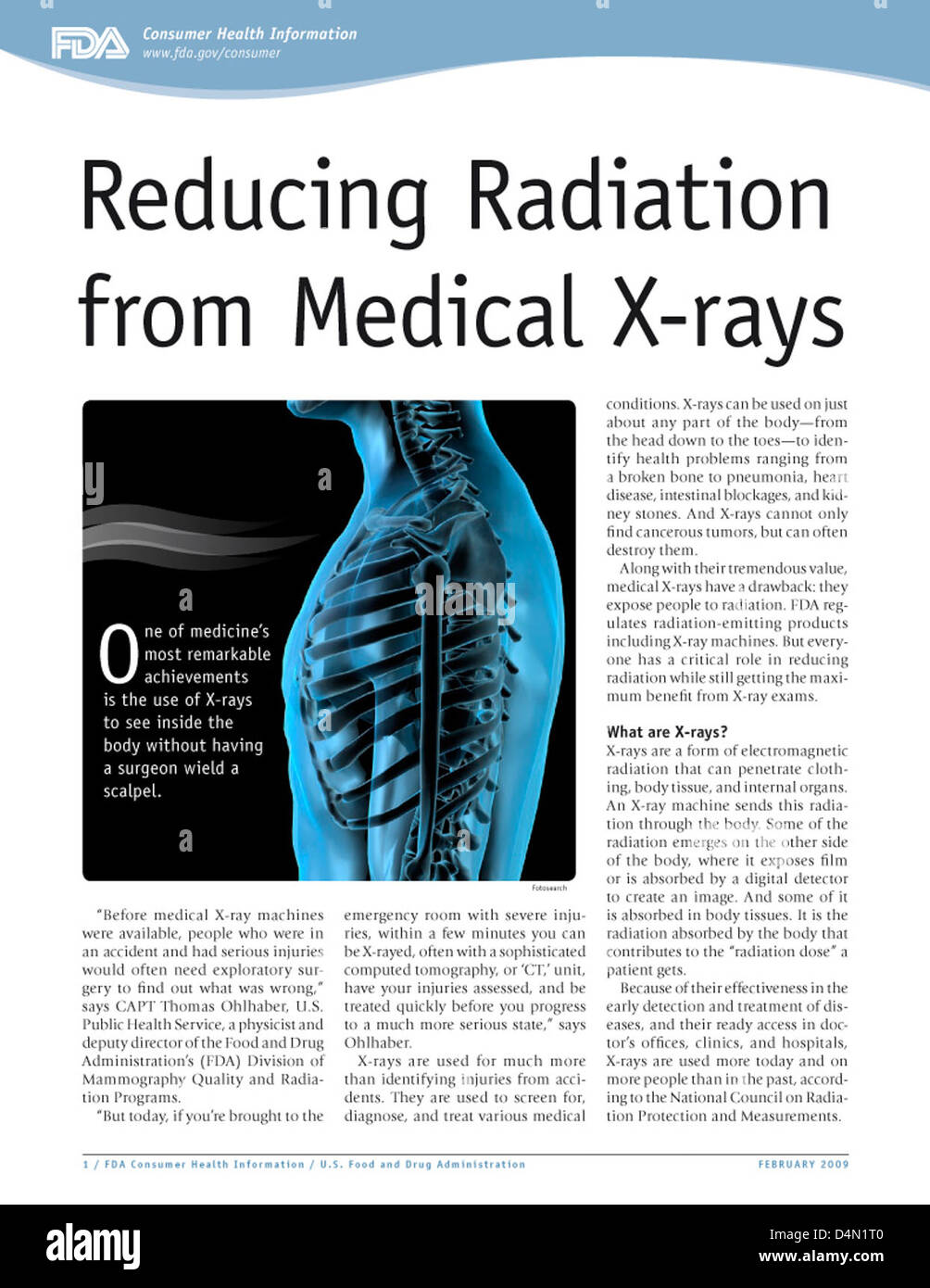 Réduire le rayonnement de la radiographie médicale Banque D'Images