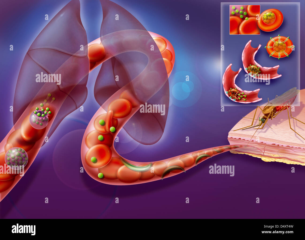 Le paludisme, ILLUSTRATION Banque D'Images