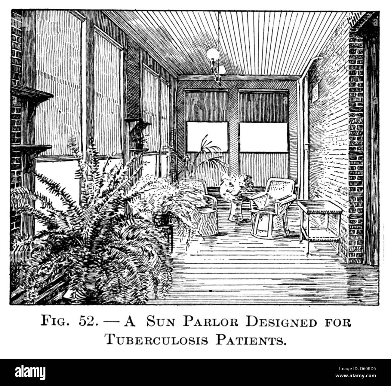 Cette image est tirée de 'physiologie et santé' (1916), mettant l'accent sur le thème de la consommation, un ancien terme pour désigner la tuberculose. La photographie comprend probablement une illustration pédagogique ou un diagramme expliquant les effets et les symptômes de la tuberculose, typique de l'éducation sanitaire du début du XXe siècle. Banque D'Images