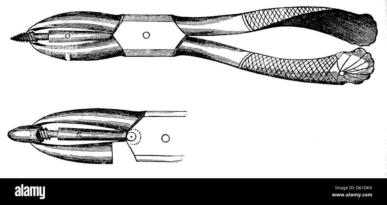 Un manuel de 1868 détaillant les méthodes d'extraction dentaire, offrant des conseils professionnels et des instructions pour les dentistes au XIXe siècle. Il comprend des illustrations des outils et techniques dentaires couramment utilisés pendant la période. Banque D'Images