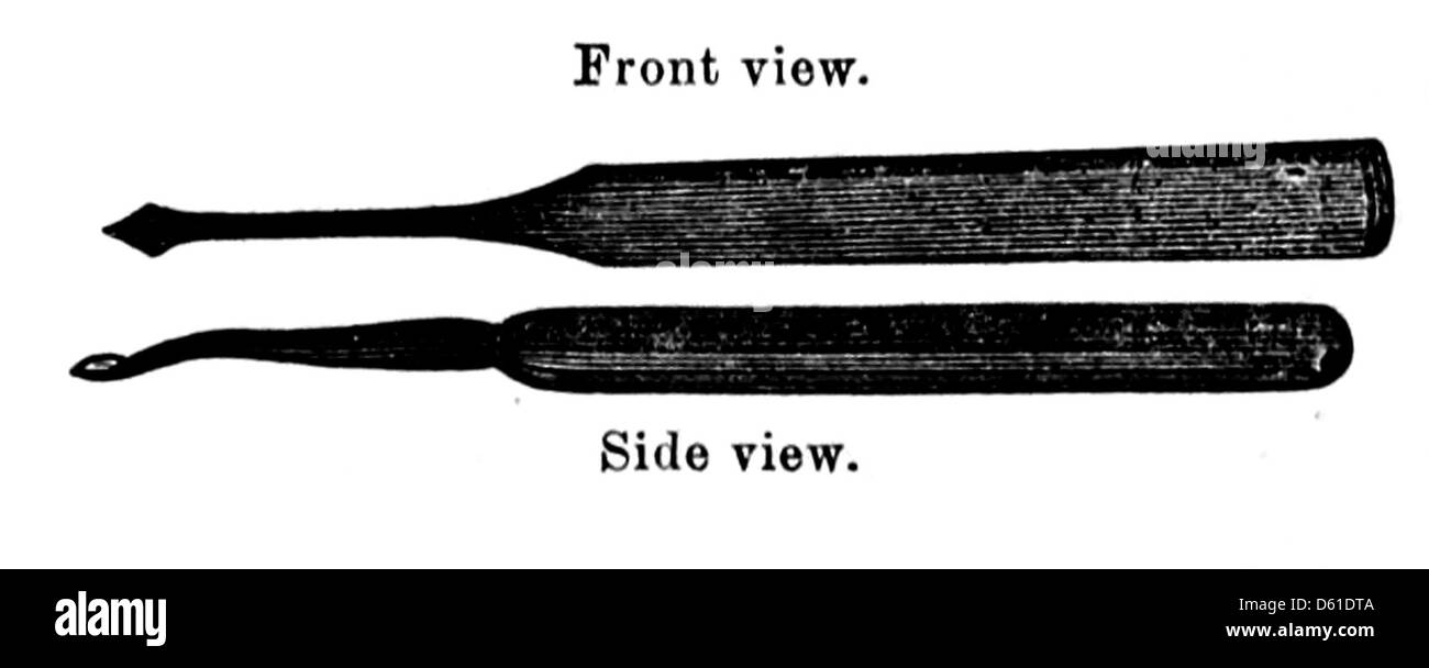 Ce manuel de 1868 illustre les techniques et outils utilisés par les dentistes pour extraire les dents. L'image fournit une vue détaillée des premiers instruments et pratiques dentaires, offrant un aperçu des soins dentaires du XIXe siècle. Banque D'Images