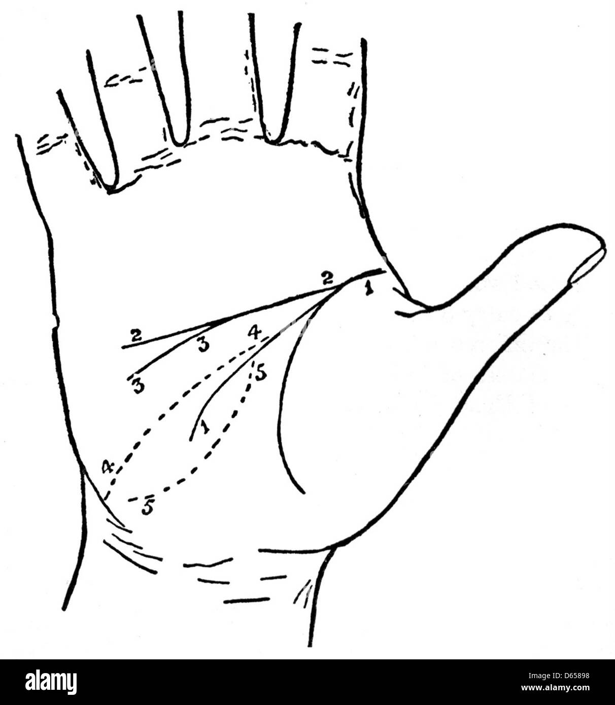 Une illustration de la palmistie de la main, montrant les lignes et les montures sur la paume utilisée pour raconter des fortunes et la lecture de la paume. Cette image, étiquetée « Fig. 12', est dans le domaine public et met en valeur la pratique de la palmistie. Banque D'Images
