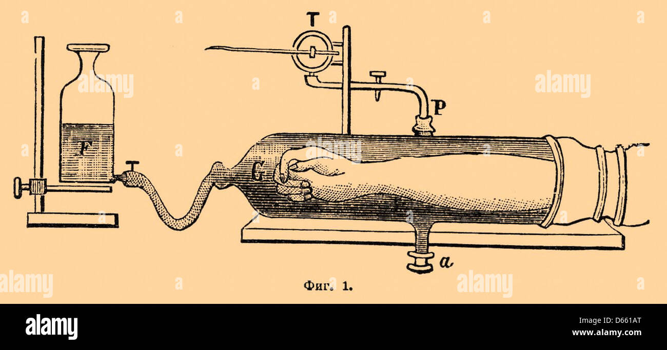 Cette image du dictionnaire encyclopédique Brockhaus et Efron présente une illustration d'un dispositif médical, publié en Russie et maintenant dans le domaine public, mettant en évidence la technologie et le design médicaux précoces. Banque D'Images