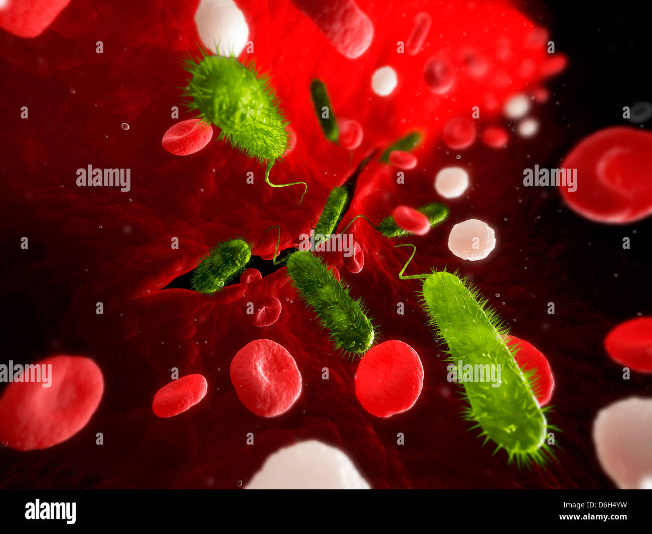 L'infection bactérienne, artwork Banque D'Images