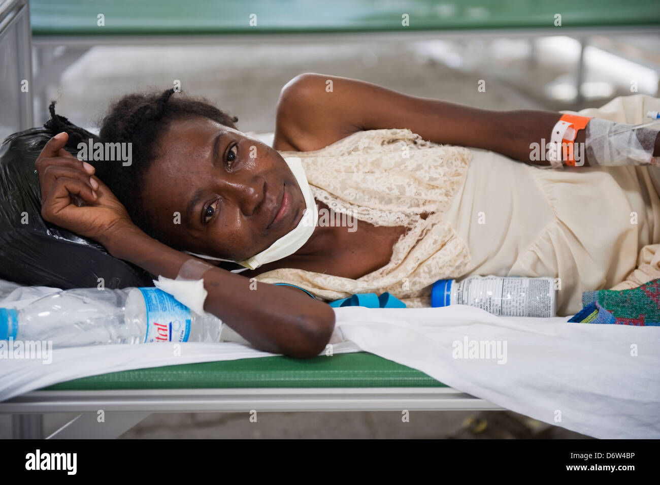 Victime du VIH, de la tuberculose du patient de l'hôpital après le tremblement de terre de janvier 2010, l'hôpital général, de Port-au-Prince, Haïti, Caraïbes Banque D'Images