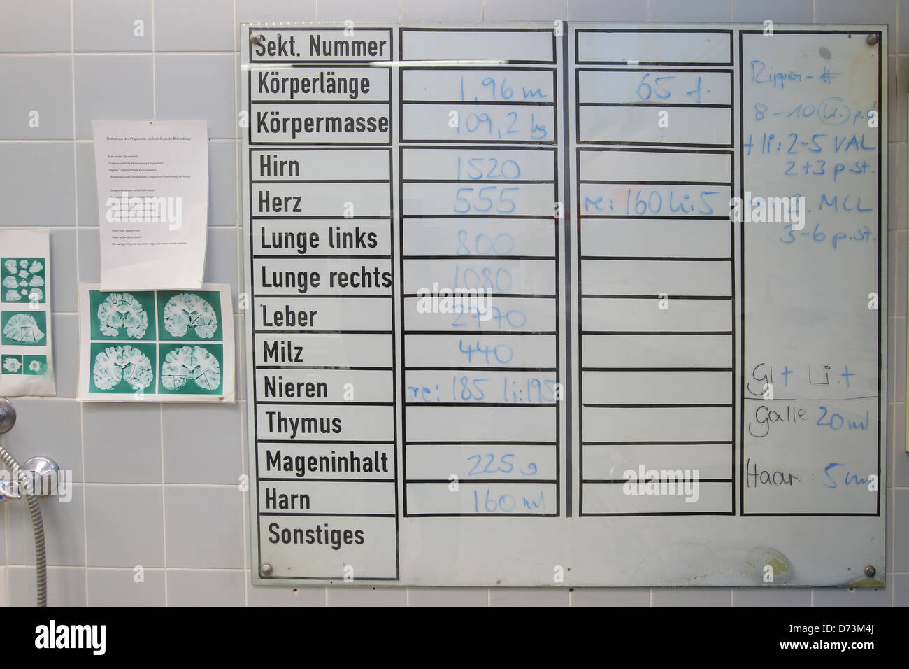 Kiel, Allemagne, un panneau dans la salle d'autopsie à l'Institut de médecine légale de la UKSH Banque D'Images