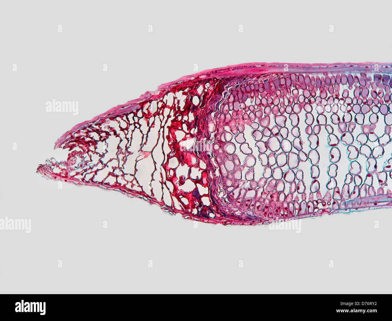 La section longitudinale qui a endommagé les aiguilles de sapin avant pleine croissance atteint 100x de grossissement Banque D'Images