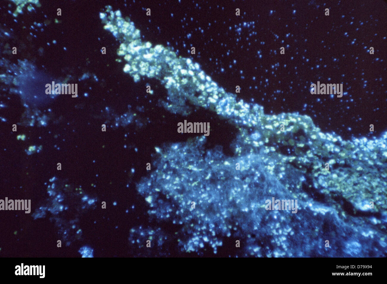 Histoplasma capsulatum antigènes Banque D'Images