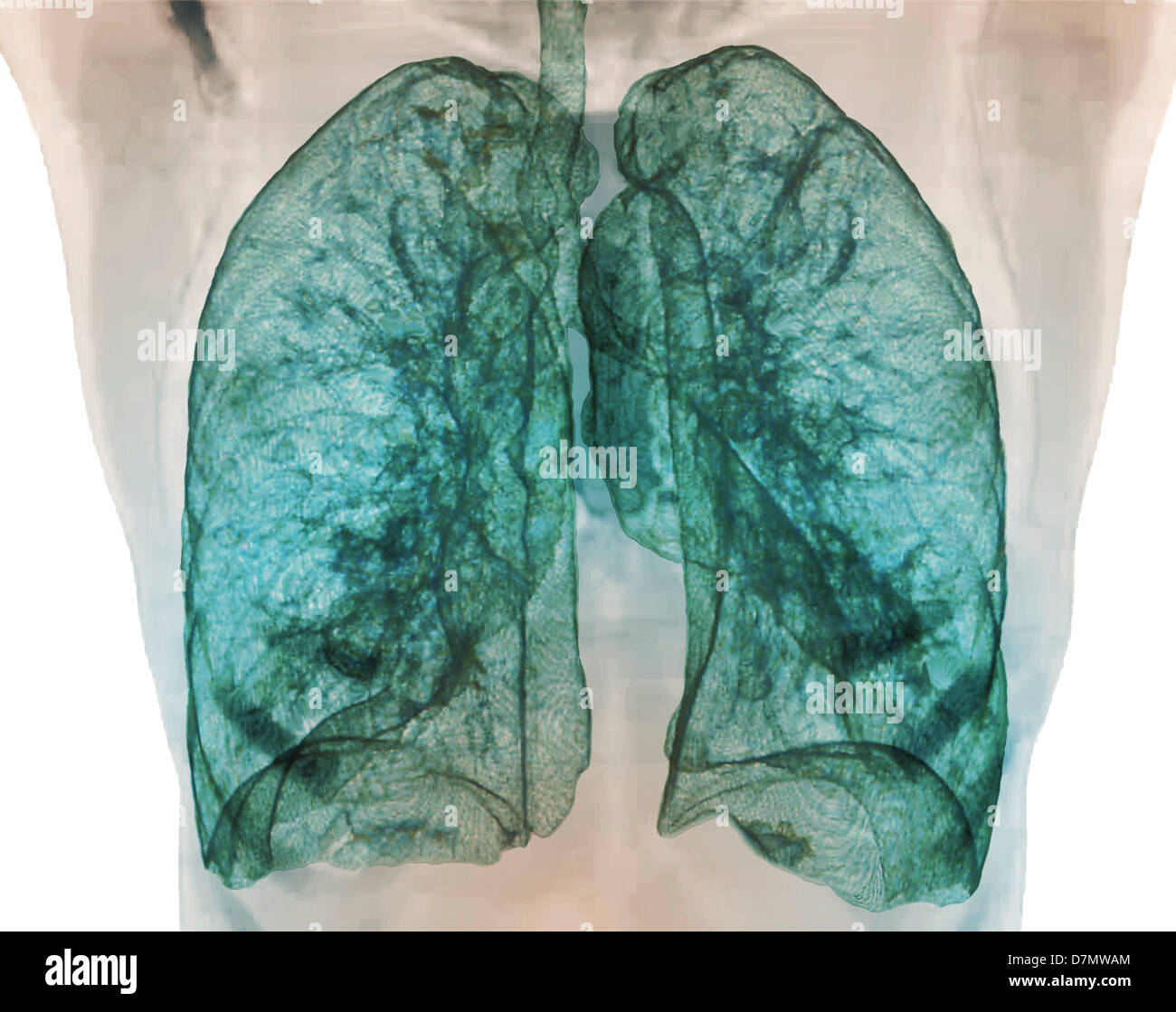 La santé des poumons, scanner 3D Banque D'Images