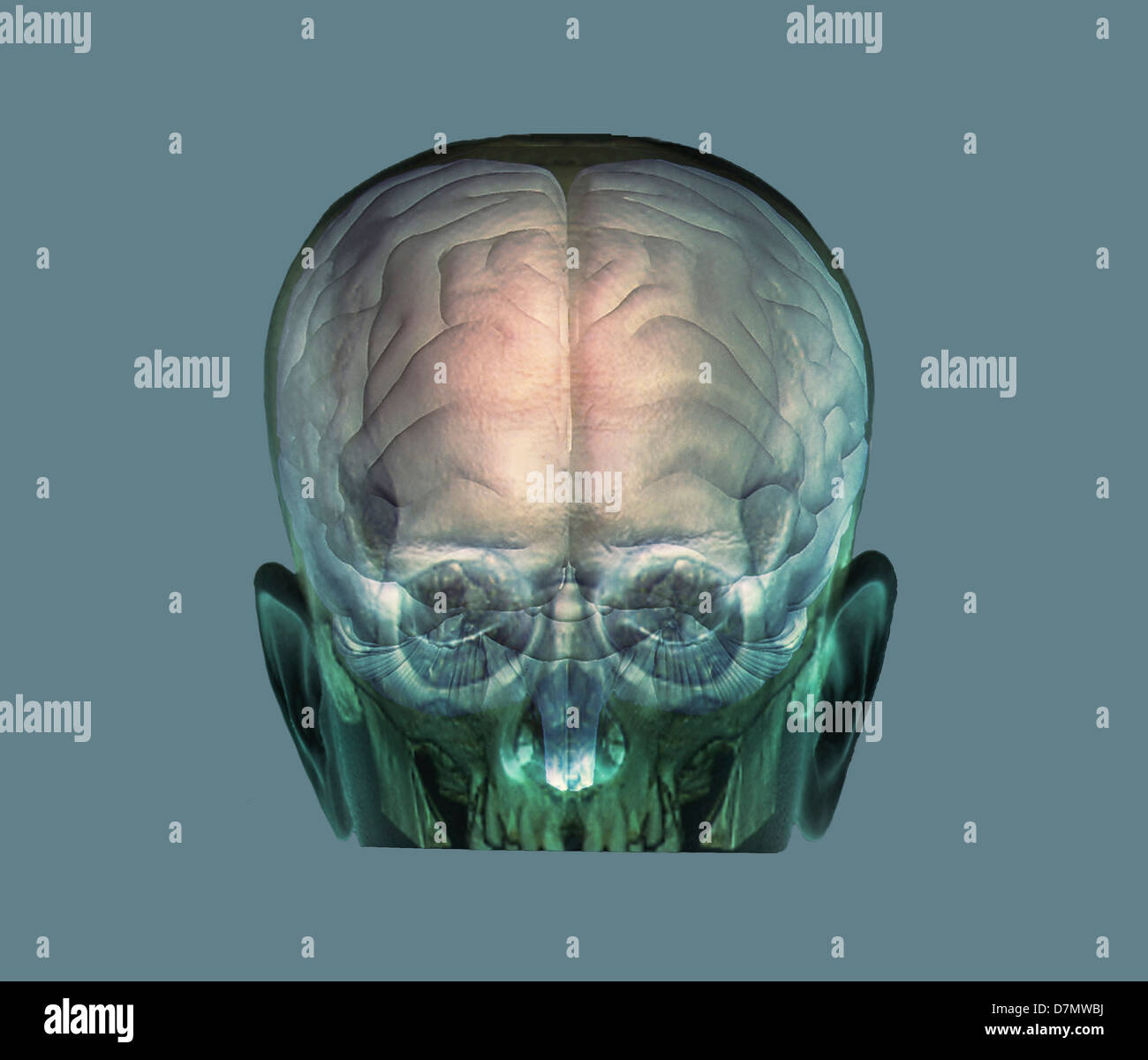 La tête humaine, 3D CT et IRM Banque D'Images