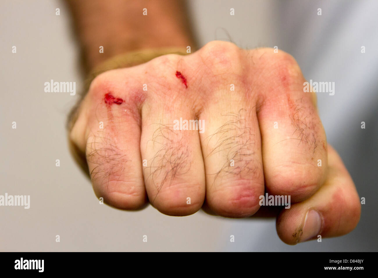 Bloody Knuckles Banque D'Images