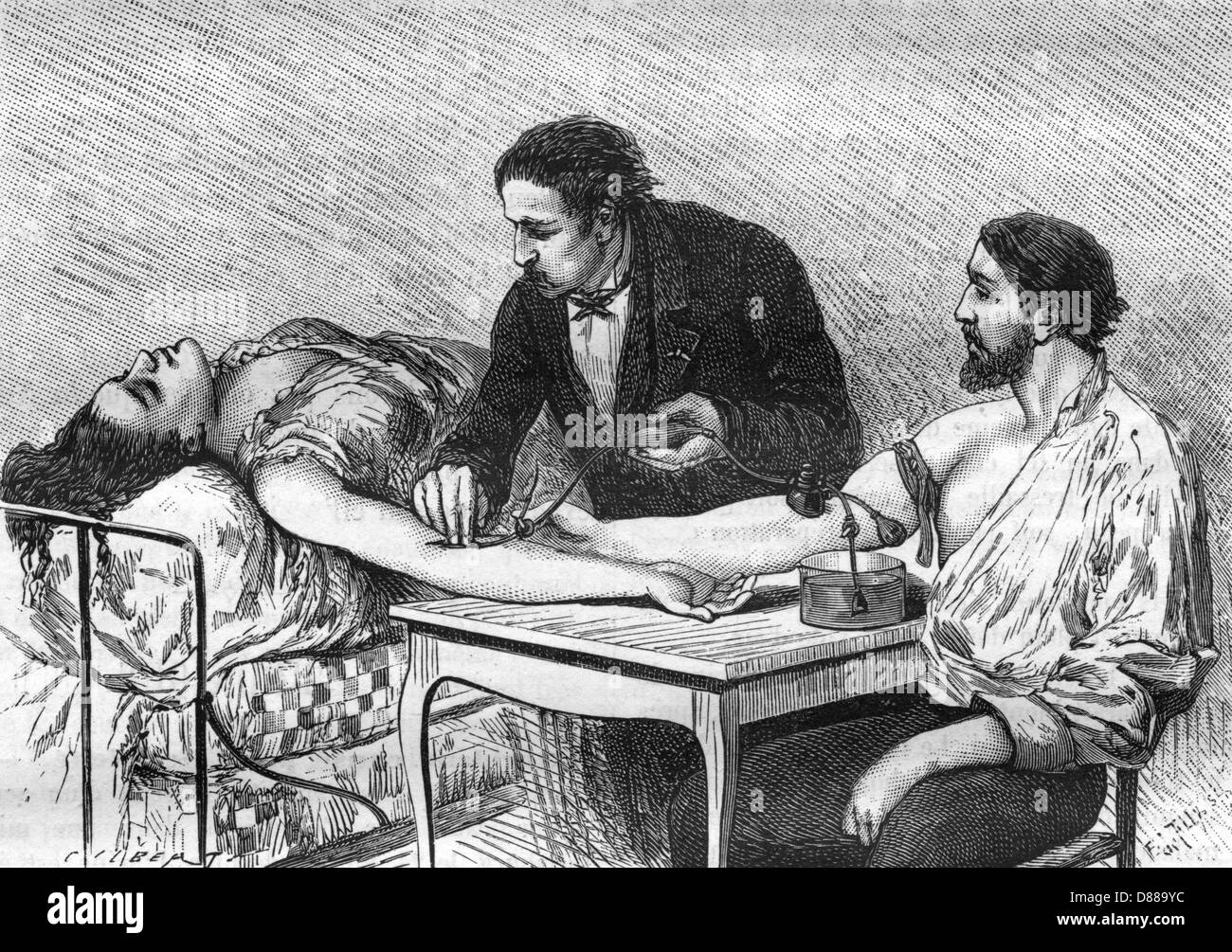Transfusion sanguine - 1882 Banque D'Images