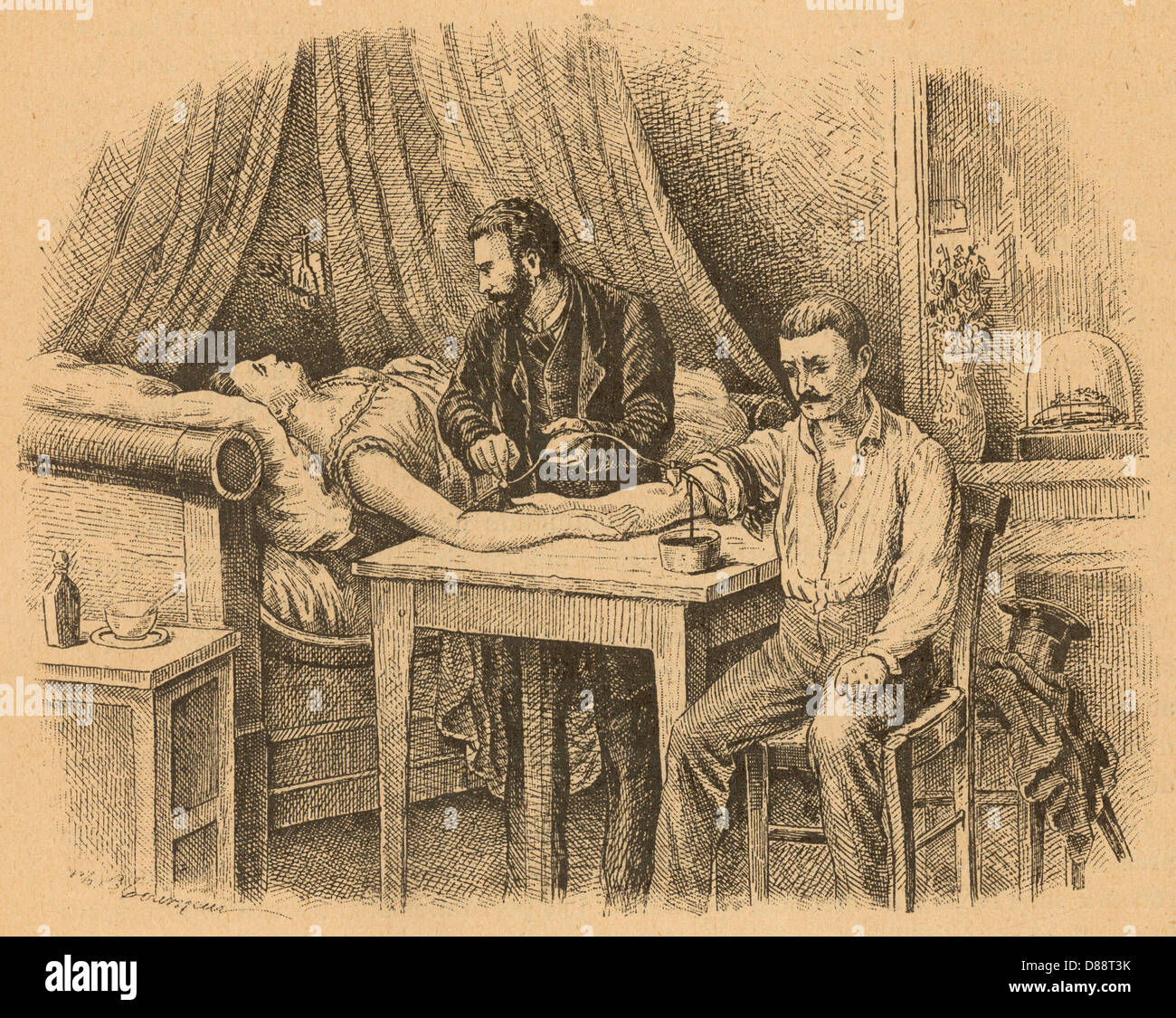 Sang transfuseurs 1880 Banque D'Images