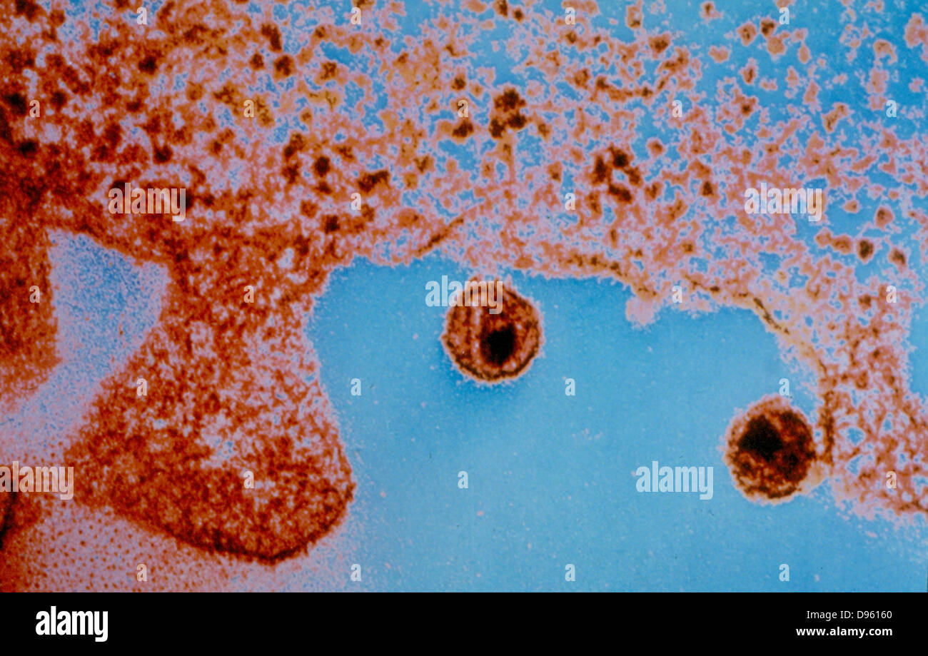 Image du virus du sida de l'Ouganda. Organisation mondiale de la santé/Institut Pasteur. Banque D'Images