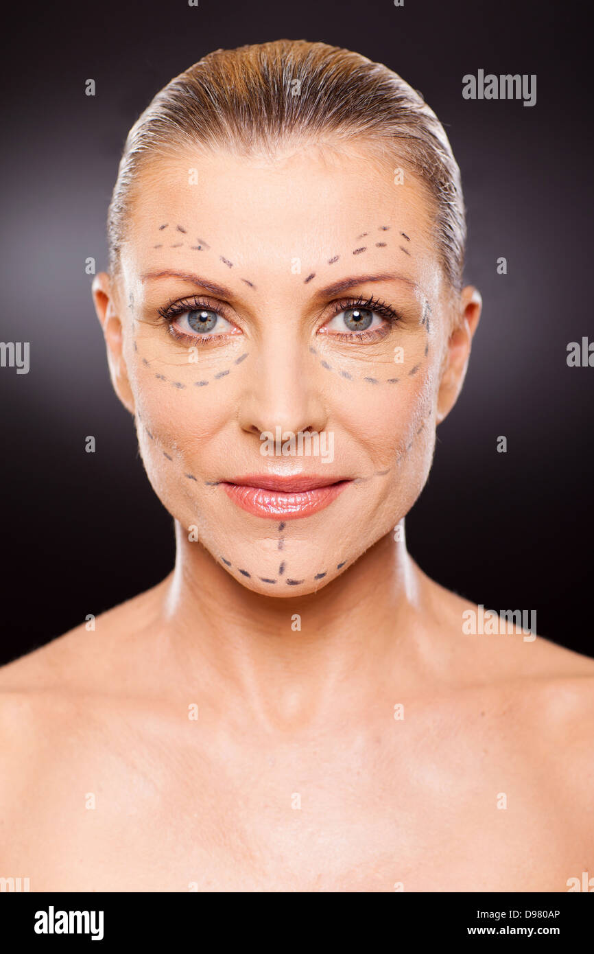 Chirurgie Plastique Banque De Photographies Et Dimages Haute