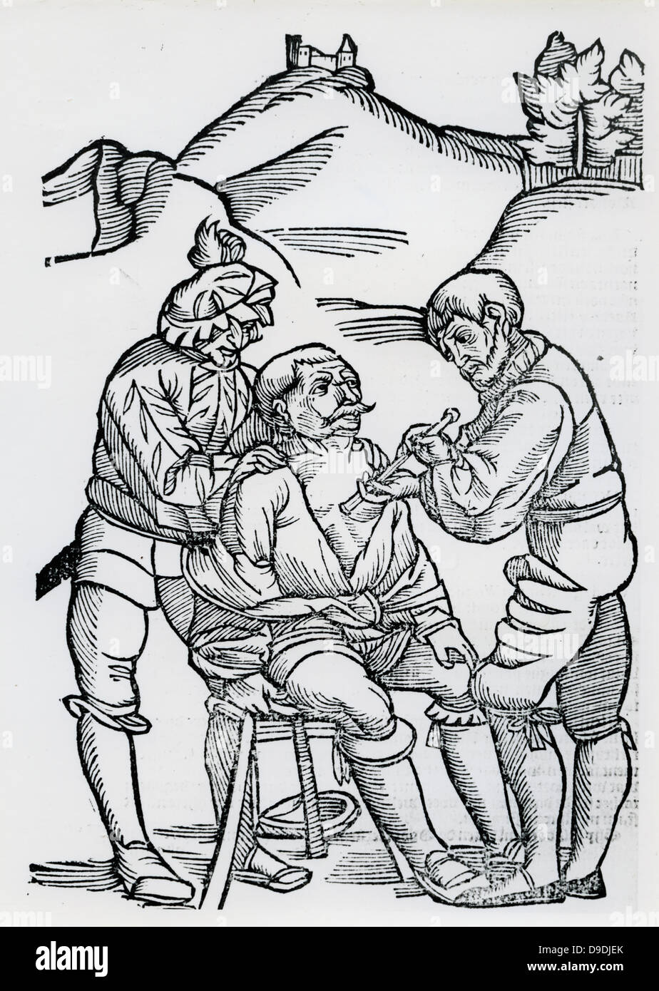 Chirurgien de traiter un soldat blessé. Gravure sur bois à partir d'un livre sur la chirurgie de champ, 1593. Banque D'Images
