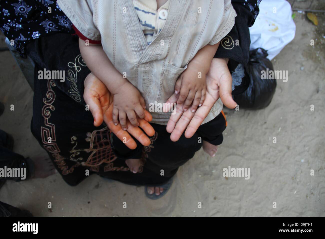 Ou mauvaise place pour examiner condamne son bébé, qui souffre d'anémie due à la malnutrition et la pauvreté, à Gaza Banque D'Images