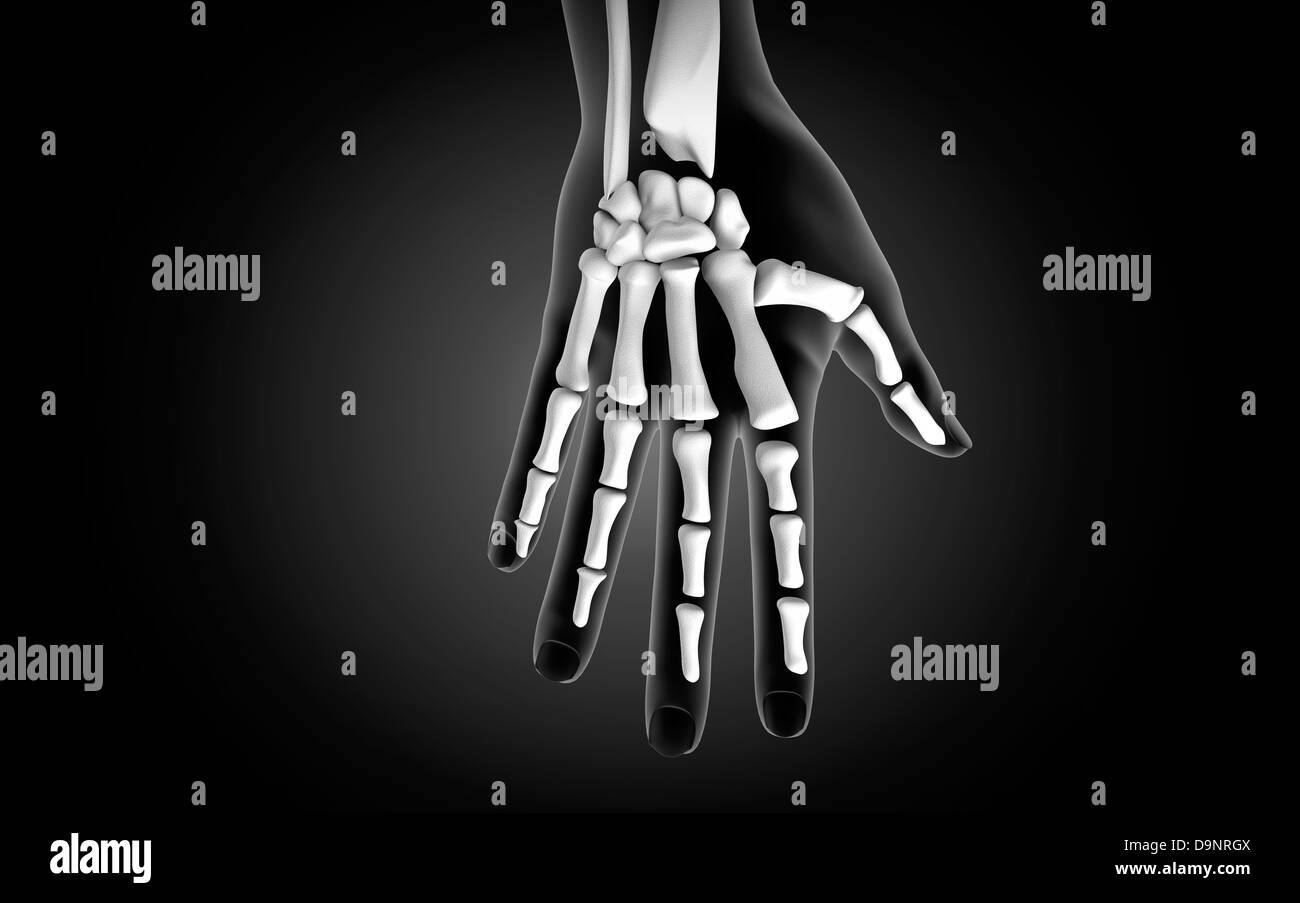 La vue X-ray de main humaine. Banque D'Images