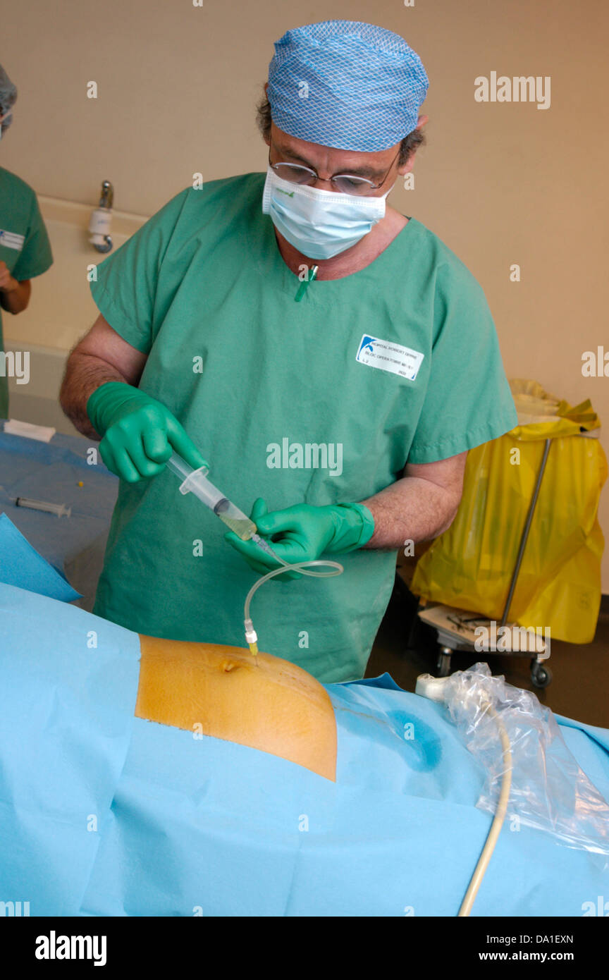 AMNIOCENTÈSE Banque D'Images