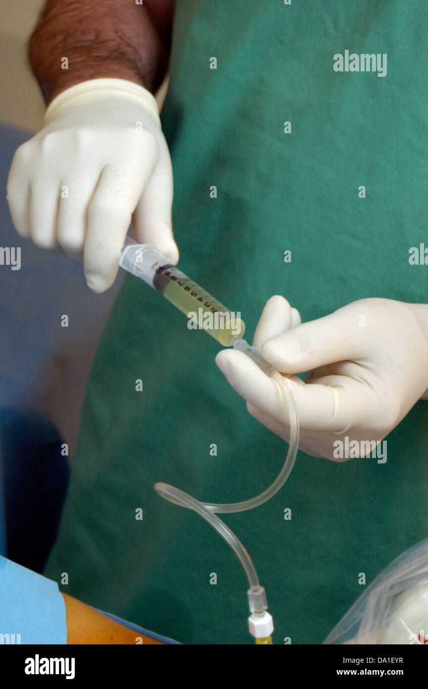 AMNIOCENTÈSE Banque D'Images