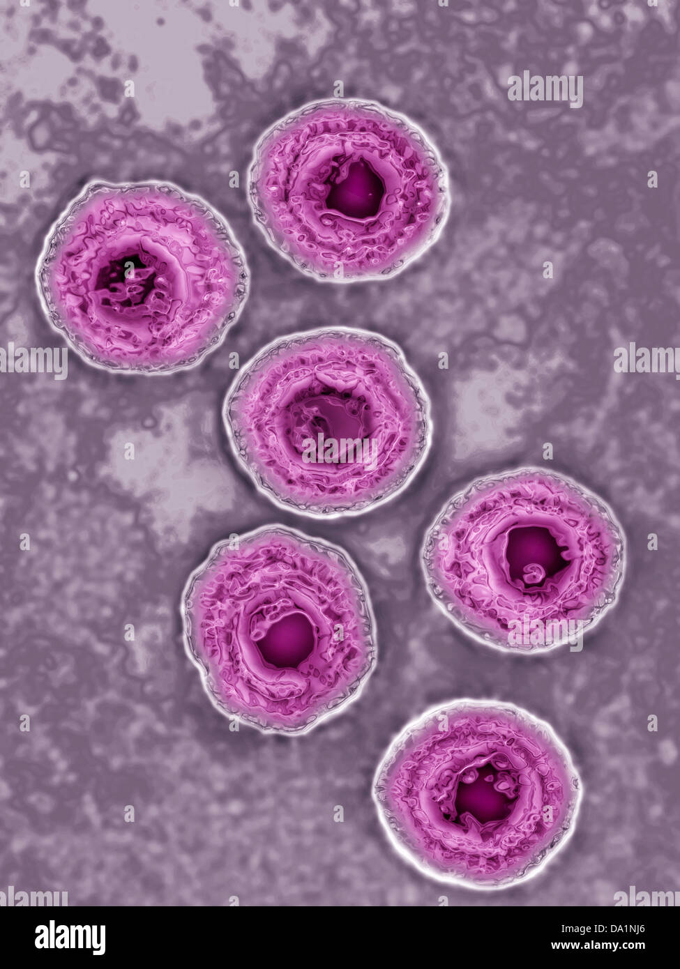LHERPS SIMPLEX VIRUS Photo Stock - Alamy